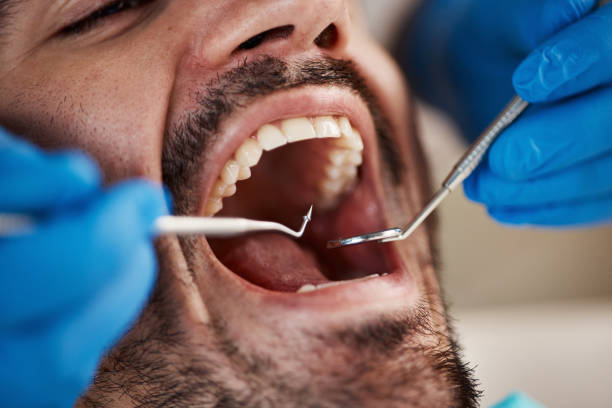 Best Emergency Root Canal Treatment in Frankfort, KY